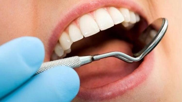 20 Yaş Dişleri ve Olası Problemleri