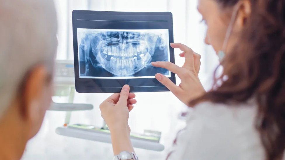 Periodontitis: Yaygın Bir Ağız Hastalığı