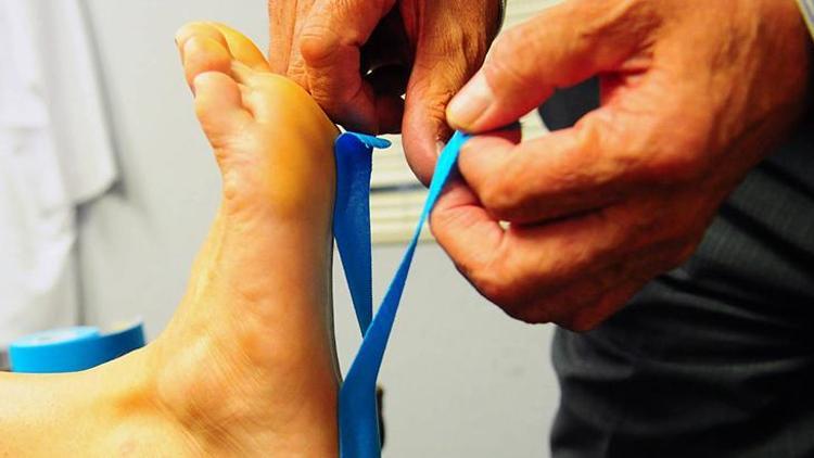 Ayak Ağrıları ve Topuk Dikeninin Nedenleri ile Tedavi Yöntemleri
