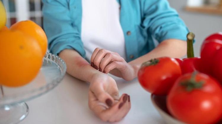 Besin Alerjisi Nedir?