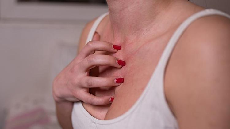 Besin Alerjisi: Nedenleri, Belirtileri ve Tedavi Yöntemleri