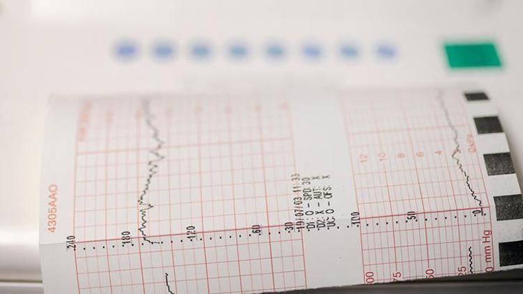Bypass Ameliyatı: Riskleri ve Sonrası Dikkat Edilmesi Gerekenler