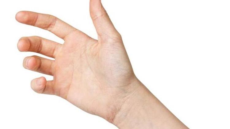 De Quervain Sendromu: Nedenleri, Belirtileri ve Tedavi Yöntemleri