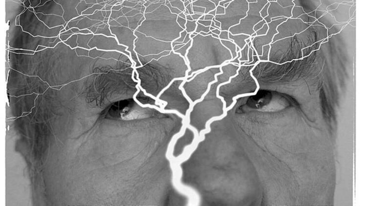 Epilepsi Hastalığı Hakkında Bilinmesi Gerekenler