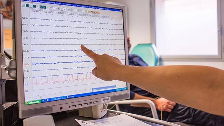 Epilepsi Hastalığı Hakkında Bilinmesi Gerekenler