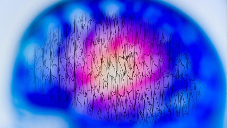 Epilepsi Hastalığı Hakkında Bilinmesi Gerekenler