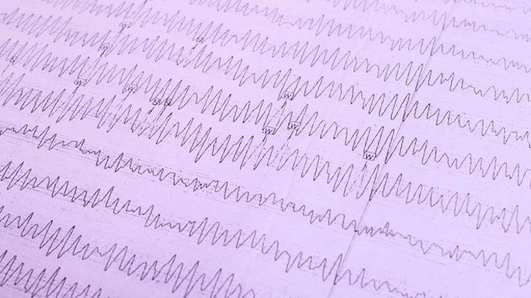 Epilepsi Hastalığı Hakkında Bilinmesi Gerekenler