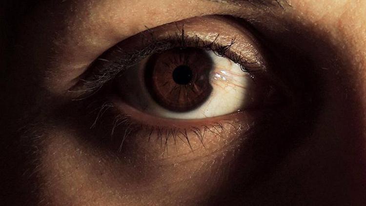 Göz Kızarıklığı ve Pterjium