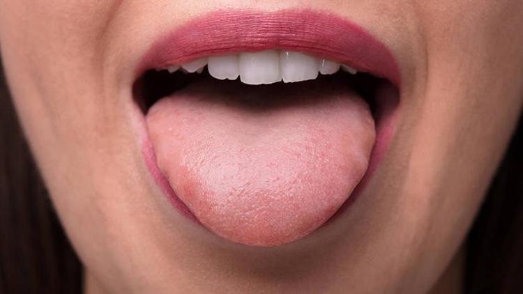 Harita Dil Nedir? Belirtileri ve Tedavi Yöntemleri