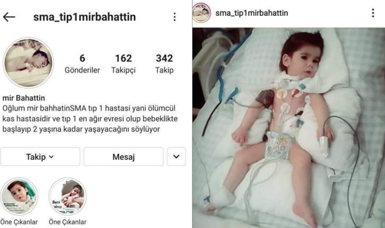 Hikmet Bolat'tan SMA Hastalığı Üzerine Duygusal Açıklamalar