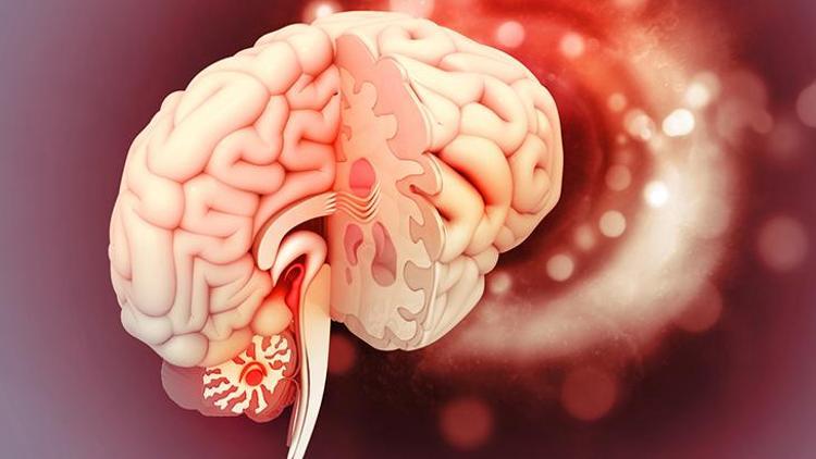 Hipofiz Adenomları: Belirtileri ve Tedavi Yöntemleri