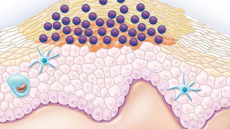 HPV Hakkında Bilgiler ve Aşılar