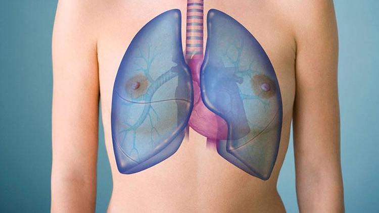 İdiyopatik Pulmoner Fibrozis (İPF): Belirtileri, Tanısı ve Tedavisi