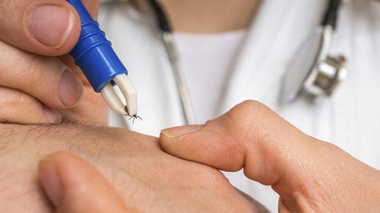 Lyme Hastalığına Neden Olan Bakteriler