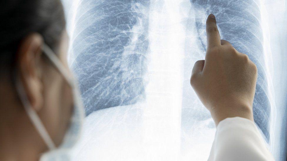 Kanserin Evrimsel Analizi: Tümörlerin Sonsuz Değişim Yeteneği