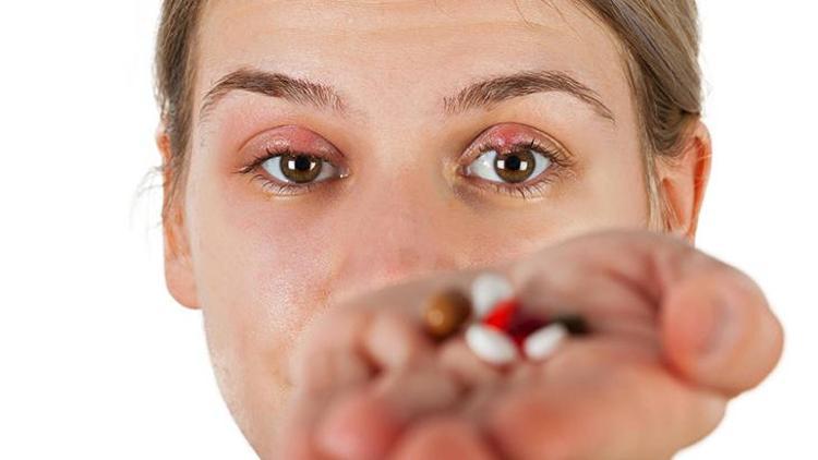 Kırmızı Göz ve Alerjik Konjonktivit: Nedenleri, Belirtileri ve Korunma Yöntemleri