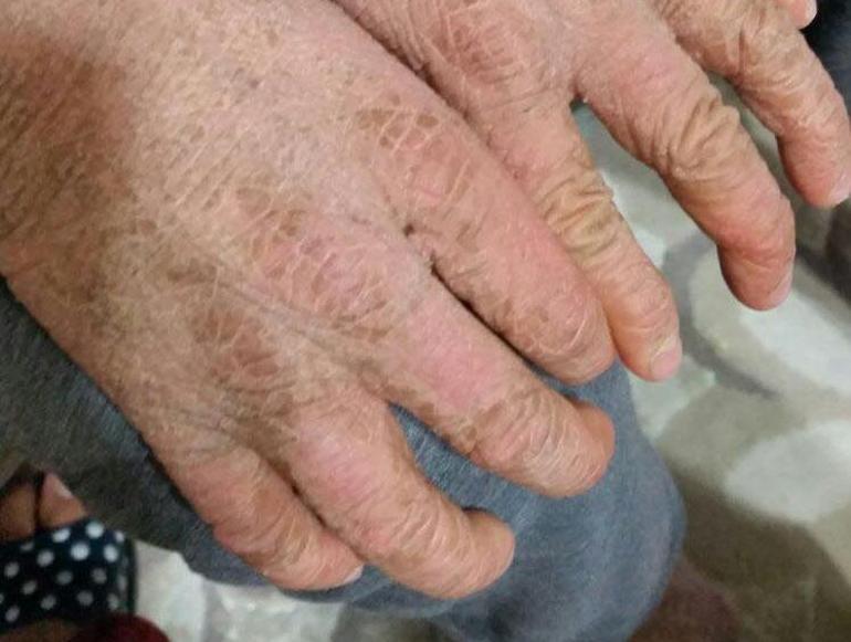 Manisa'da Sağlık Ekiplerinden Ücretsiz İlaç Desteği