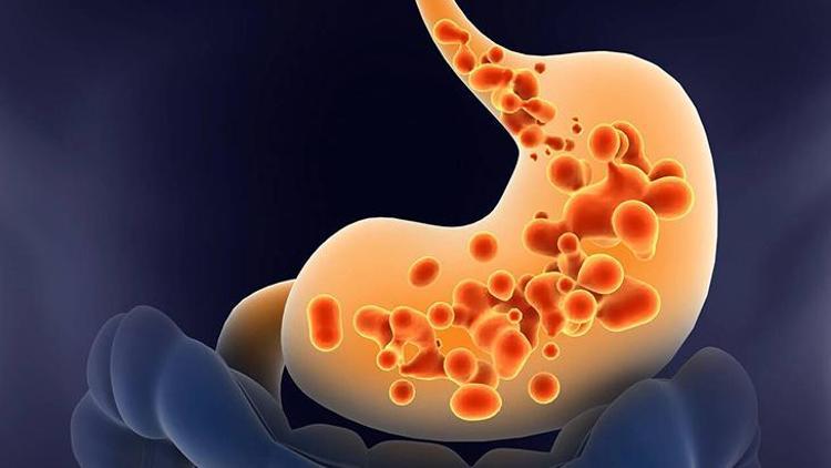 Mide Sağlığı: Ağrı, Gastrit ve Ülser Tedavisi