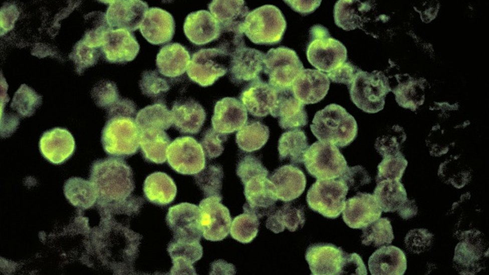 Naegleria fowleri Enfeksiyonları: Tehlike ve Önlemler