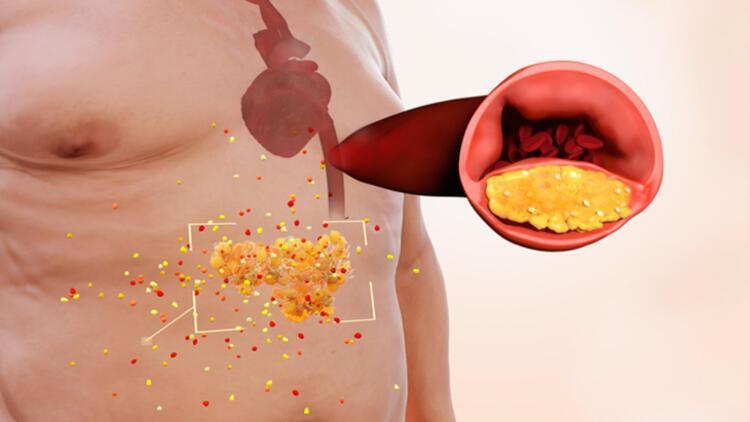 Obezitenin Kalp Sağlığı Üzerindeki Etkileri ve Obezite Cerrahisi
