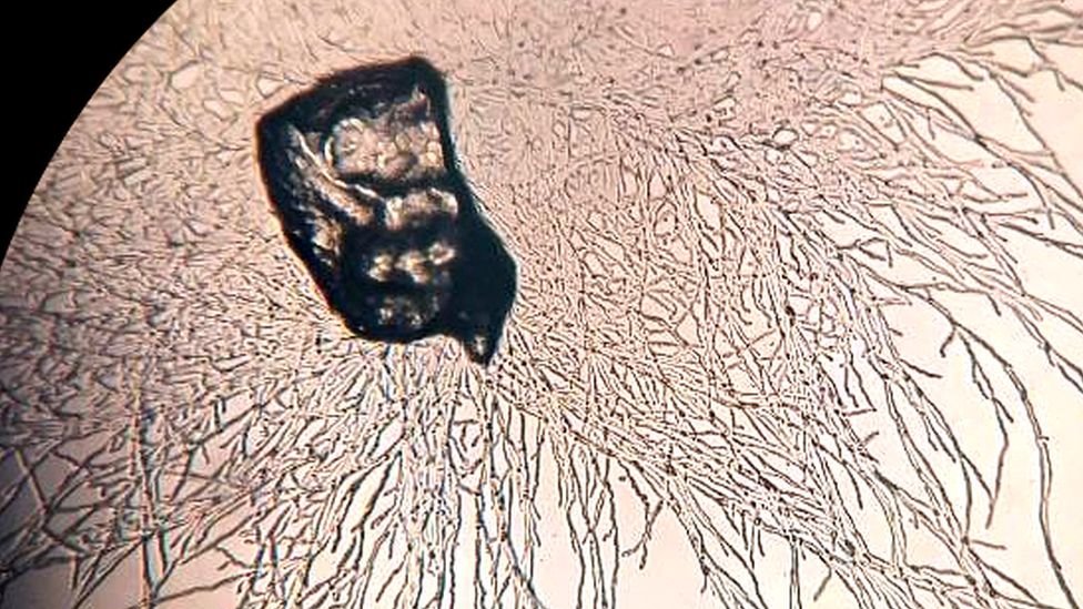 Plastik Yiyen Bakteri: Çığır Açan Bir Keşif