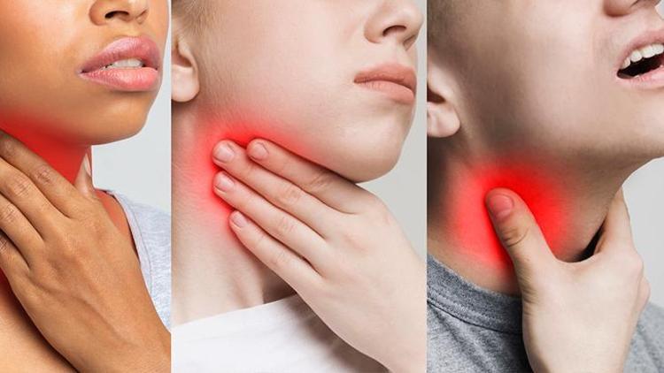 Tonsilit Nedir? Belirtileri, Nedenleri ve Tedavi Yöntemleri