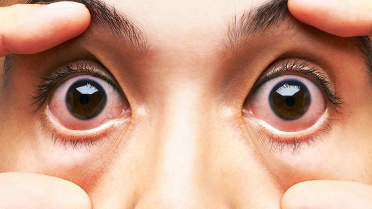 Vitamin Eksikliklerinin Belirtileri ve Önemi