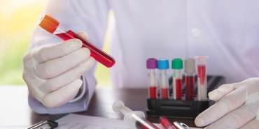 immunoloji-nedir-neye-bakar-alerji-ve-bagisiklik-sistemi-hastaliklari-hekimi-hangi-hastaliklara-bakar-D7PCi2yj.jpg