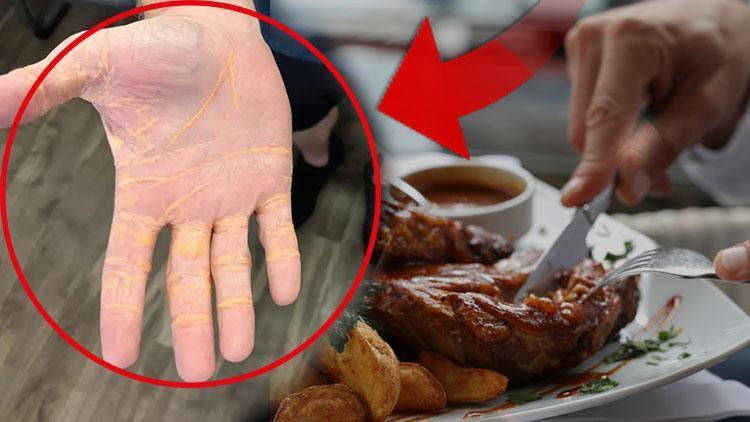 Kilo Yönetimi ve Sağlık Üzerindeki Etkileri
