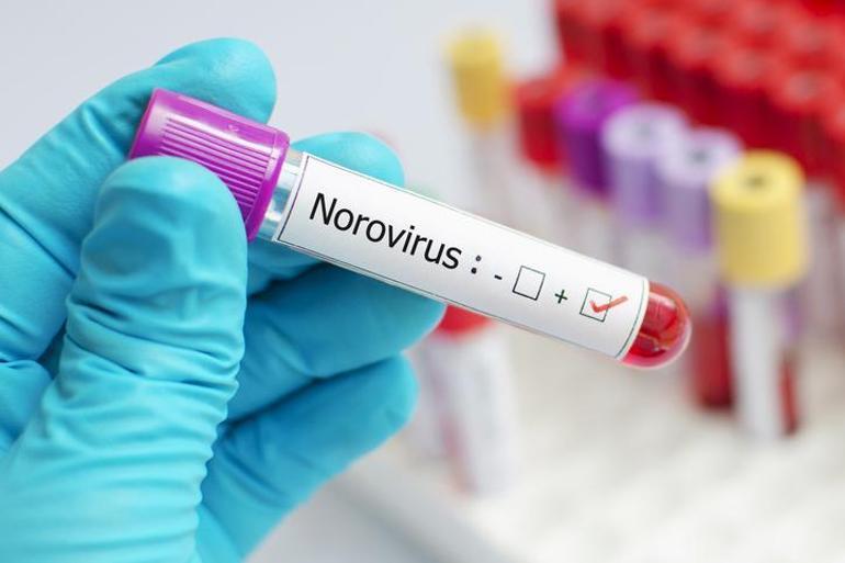Norovirüs Vakalarıyla İlgili Kişisel Deneyimler
