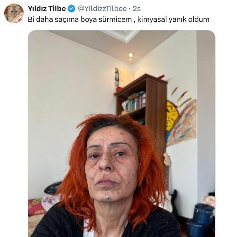 Ünlü Şarkıcıdan Duygusal Paylaşım